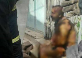 Iranian worker burns himself